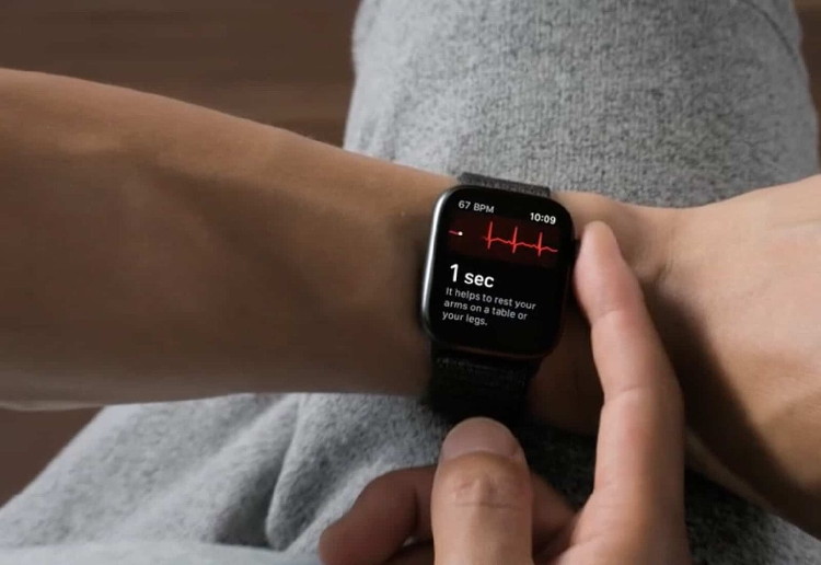 Apple Watch's AFib